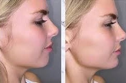 تحديد خط الفك خط الفك في دبي وأبو ظبي والشارقة والعين