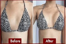 حقن الماكرولين في دبي وأبو ظبي والشارقة والعين