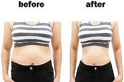 اخصائية تغذية علاجية في دبي وأبوظبي والشارقة والعين