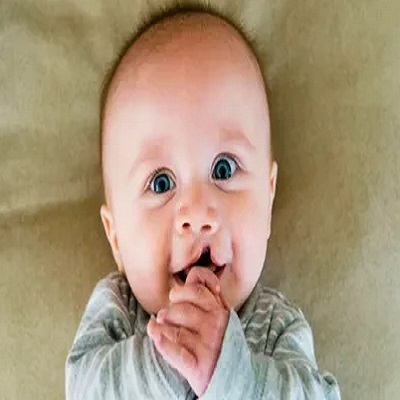 تكلفة جراحة شق الشفة في دبي تكلفة جراحة شق الشفة القحفي الوجهي في دبي، الإمارات العربية المتحدة