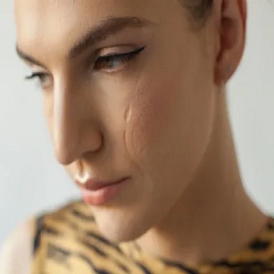 تكلفة مراجعة ندبة الوجه في دبي تكلفة مراجعة ندبة الوجه في دبي