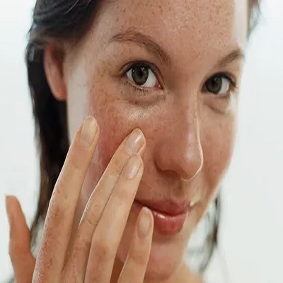 التقشير الكيميائي لعلاج الكلف لدى المرضى ذوي البشرة الداكنة التقشير الكيميائي لعلاج الكلف لدى المرضى ذوي البشرة الداكنة