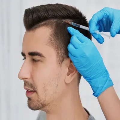 تكلفة زراعة الشعر التاج في دبي وأبوظبي والشارقة والعين