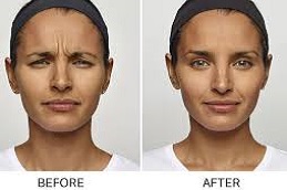 حقن ديسبورت في دبي