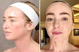 علاج المصفوفة الإلكترونية في دبي وأبو ظبي