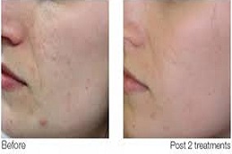 علاج المصفوفة الإلكترونية في دبي وأبو ظبي