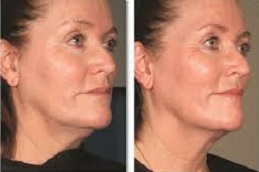 علاج ألثيرابي في دبي وأبوظبي