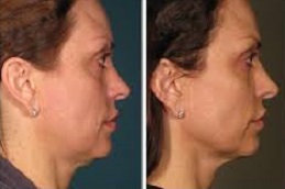 علاج ألثيرابي في دبي وأبوظبي