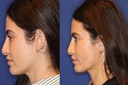 علاج ألثيرابي في دبي وأبوظبي