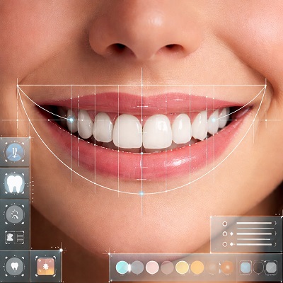 تصميم الابتسامة الرقمية في دبي