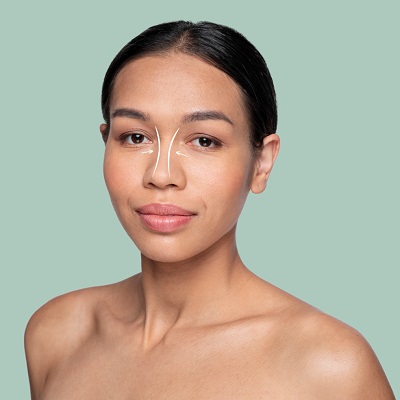 عملية تجميل الأنف